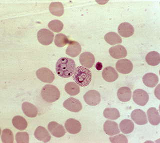 Tumour necrosis factor weak inducer of apoptosis ELISA Kit[Tumour necrosis factor weak inducer of apoptosis] | Technique alternative | 03015475079