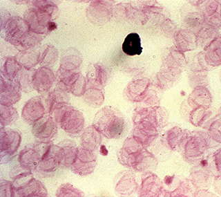 XIAP (X Linked Inhibitor of Apoptosis, X-linked Inhibitor of Apoptosis Protein, X-linked IAP, Apoptosis Inhibitor 3, API3, Baculoviral IAP Repeat 4, Baculoviral IAP Repeat- Protein 4, BIRC4, HILP, IAP 3, IAP3, IAP-like Protein, ILP-1,[XIAP] | Technique alternative | 02015402672