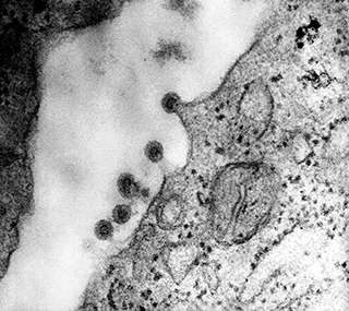 Tumor necrosis factor- apoptosis- ligand ELISA Kit[Tumor necrosis factor- apoptosis- ligand] | Technique alternative | 03015469048