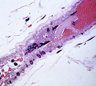 Porcine Tumor necrosis factor- apoptosis- ligand 4 ELISA Kit[Tumor necrosis factor- apoptosis- ligand 4] | Technique alternative | 03015473596